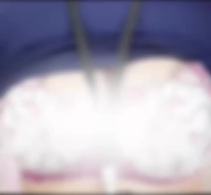 恥ずかしいからぼかしてます🫣笑