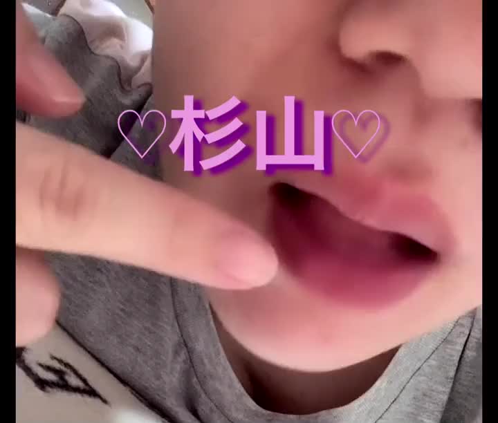 火傷しました、、、