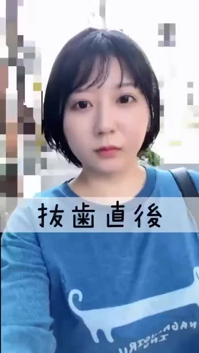お久しぶりですꉂꉂ😆
かなりギリギリの投稿になってしまいました😛

いやー…微塵も腫れなくてですね。😇
パンパンに腫れて四角くなった顔を日記に載せるのが夢だっただけに、ものすごいテンション下がっちゃいました🫠

腫れていく様を残そうと思って3日間撮ってたんですけどね…ただ3日間自撮りしただけの奴になってしまいました。

抜歯のときは人生で1番怖い瞬間で、怖すぎて意識遠のいてるレベルだったんですが、痛みも無いまま上下２～3分程で終了しました😇

酷い痛みも、麻酔が切れた時くらいでしたね🤔次に抜くときは横向きの歯があるので、腫れるのを期待してます🤗


あ、因みに本日私のお誕生日なんですよおめでとうございます🙌😇

お祝いのメッセージもたくさんありがとうございます😖✨️朝のうちにお返事しきれなかったので、もう少々お待ち下さいー❣️