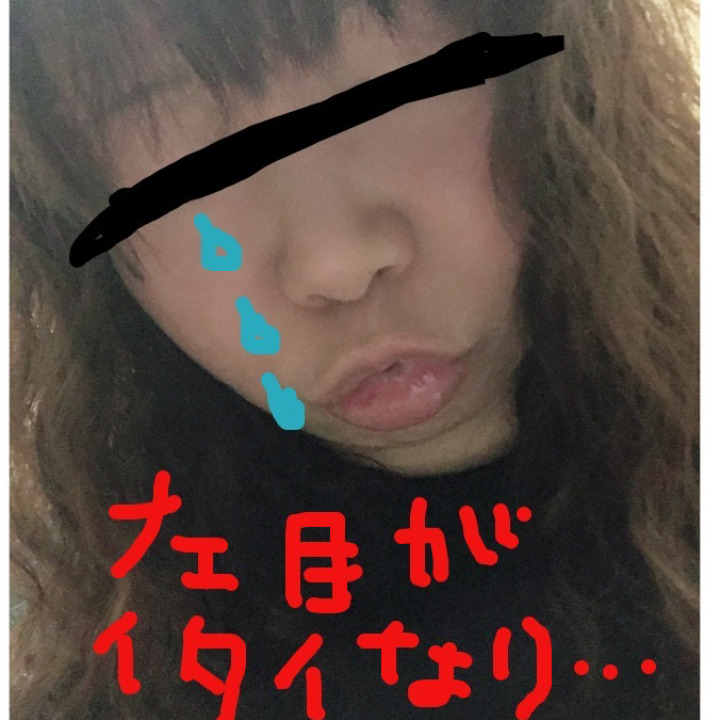 お風呂上がりのスッピンだから、モザイクならぬメザイクを入れてるよ😰何か、今日は下瞼の中にものもらいが出来たみたいで地味に痛いよ😓目薬はさしたけど、次の出勤日までに有る程度治るかな？😖私、カラコンを目に入れるから、治ってくれないと痛くて入れられないや😥早く治ります様に🤨